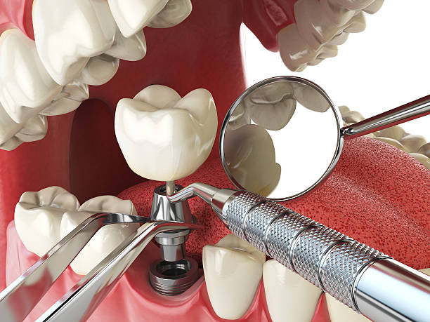 Best Cosmetic Emergency Dentistry in Quitman, MS