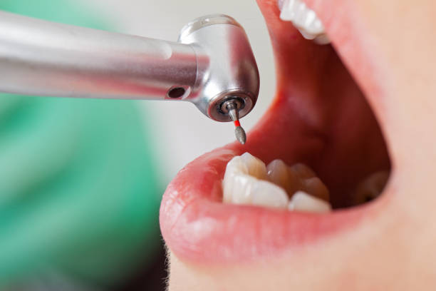 Best Cosmetic Emergency Dentistry in Quitman, MS